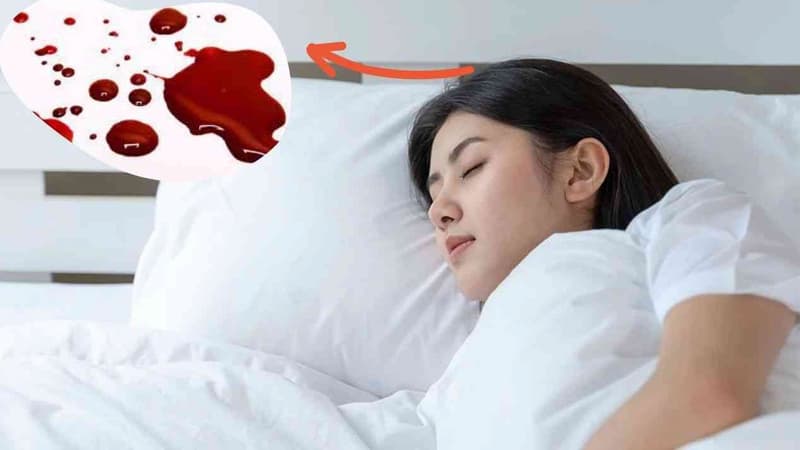 Giải mã giấc mơ thấy máu